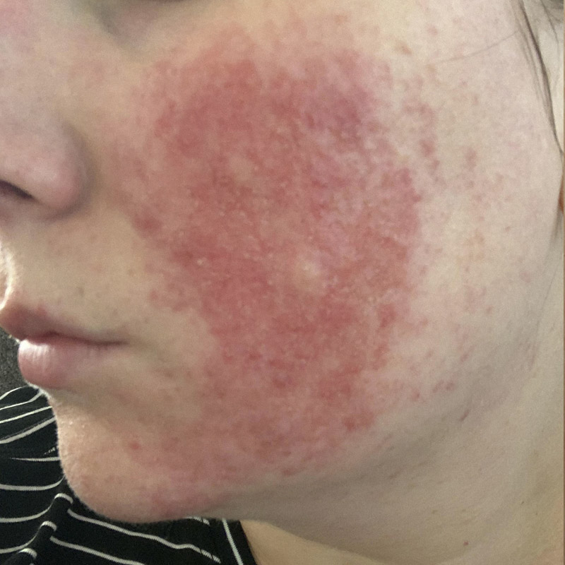 Skin Rashes – Thekliniceg, Dr. Mounir William